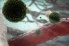 Dengue infection