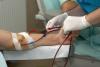 Dialysis