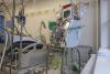 Dialysis machine in ICU