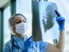 Doctor examining chest x-ray