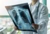 Doctor studying chest x-ray