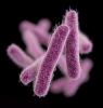 Drug-resistant Shigella