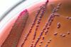 E coli colony on petri dish