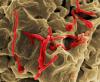Ebola virus particles