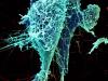 Ebola virus particles