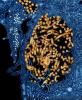 Ebola viruses