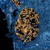 Ebola virus
