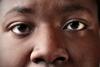 Eyes