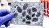 gloved monkeypox