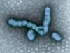 H1N1 influenza