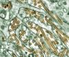 H5N1 color electron micro