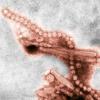Influenza A H7N9 as viewed through an electron microscope. Both filaments and spheres are observed in this photo.