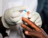 HIV fingerprick test