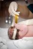 Infant head circumference