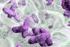 Klebsiella