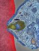 Malaria parasite attaching to human blood cell