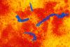 Measles virus