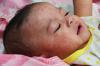 Baby with measles