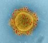 MERS virus