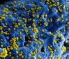 MERS-CoV particles