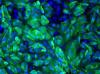 MERS-infected vero cells