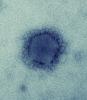 Electron microscopy of MERS-CoV