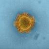 MERS coronavirus