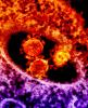 MERS virus