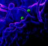 MERS virus particles