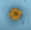 MERS virus