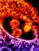 MERS virus