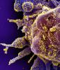 SARS-CoV-2 highly magnified