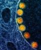 COVID-19 viruses under the microscope