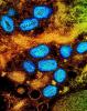 Monkeypox viruses under the microscope