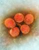 Microscope view of SARS-CoV-2 viruses