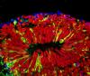 Mini brain infected with Zika