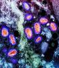 Monkeypox viruses highly magnified