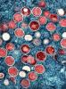 Monkeypox viruses under the microscope