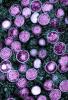 Monkeypox viruses under microscope