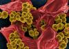 MRSA