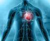 Heart inflammation illustration