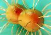 Neisseria gonorrhoeae
