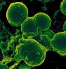 Neutrophil ingesting MRSA