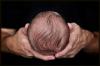 Newborn head