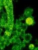 MERS-CoV micrograph