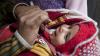 Child receiving oral polio vaccine