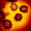SARS-CoV-2, the virus that causes COVID-19