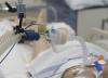 Patient on ventilator