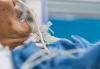 Patient on ventilator with tracheostomy