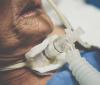 Patient with tracheostomy and ventilator